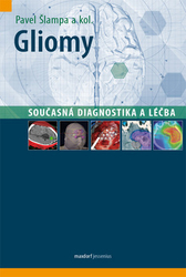 Šlampa, Pavel - Gliomy - současná diagnostika a léčba