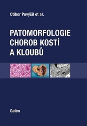 Povýšil, Ctibor - Patomorfologie chorob kostí a kloubů